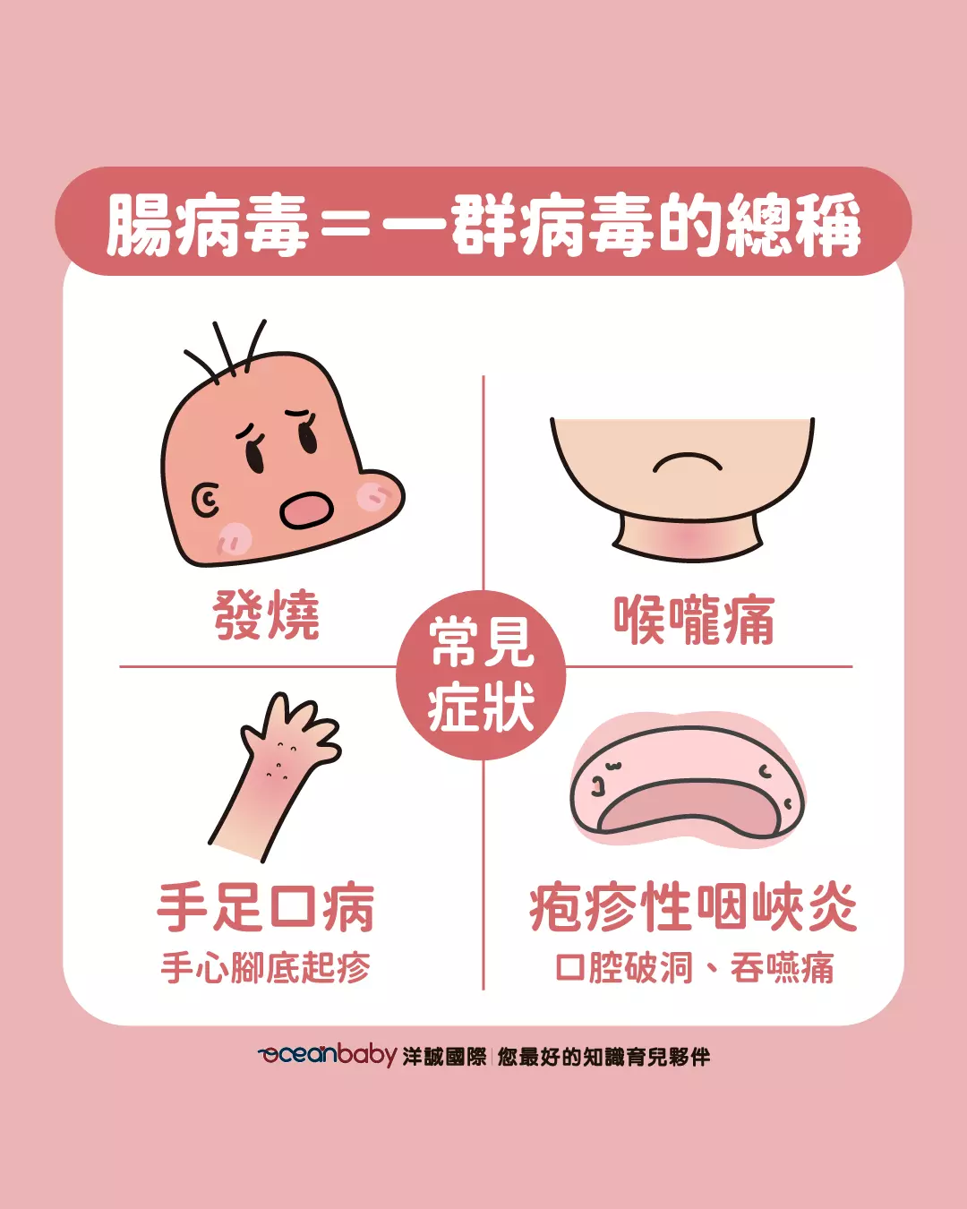 腸病毒常見症狀圖解：發燒、喉嚨痛、手足口病、疱疹性咽峽炎。